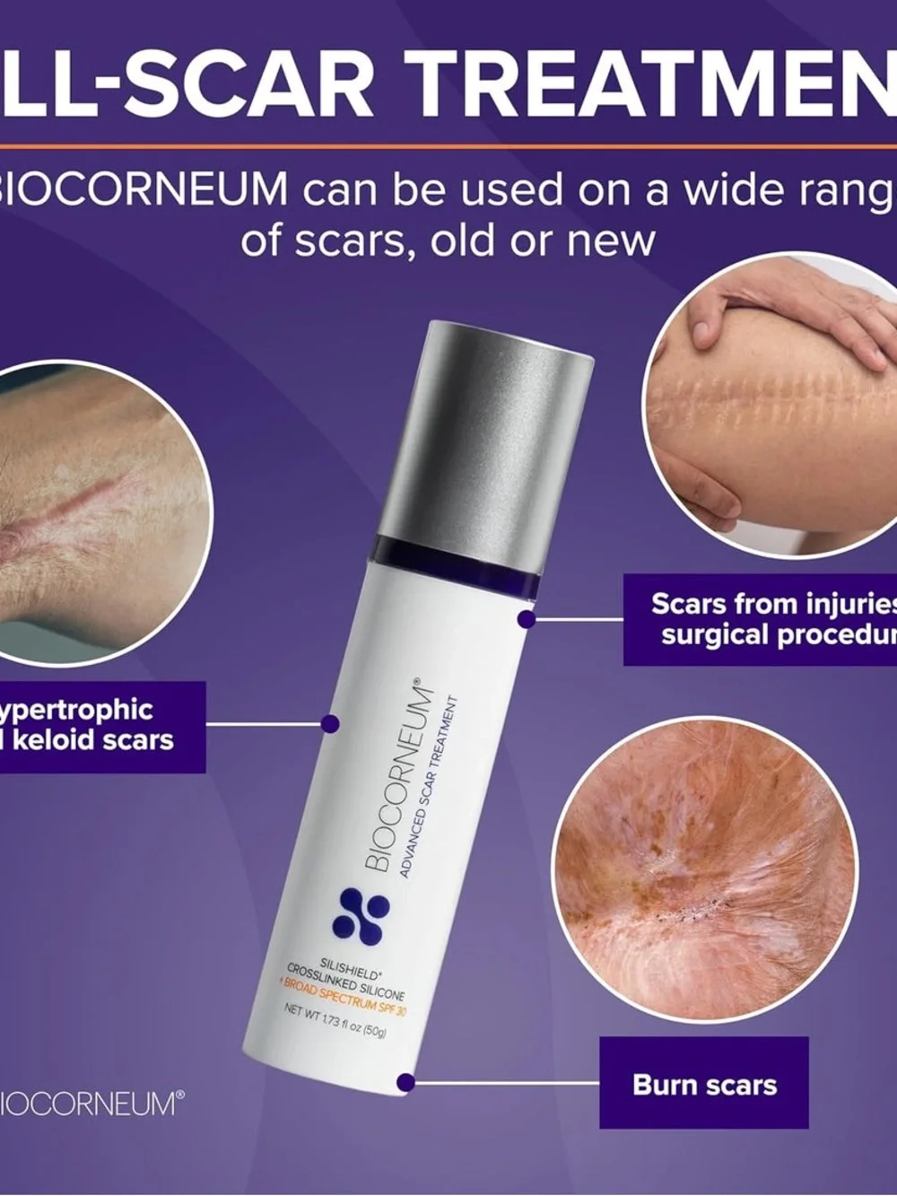 BIOCORNEUM Advanced Scar Treatment Broad Spectrum SPF 30 10g.